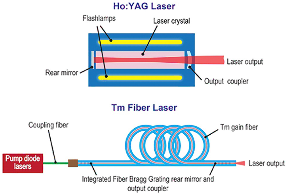 Láser de fibra  How it works, Application & Advantages